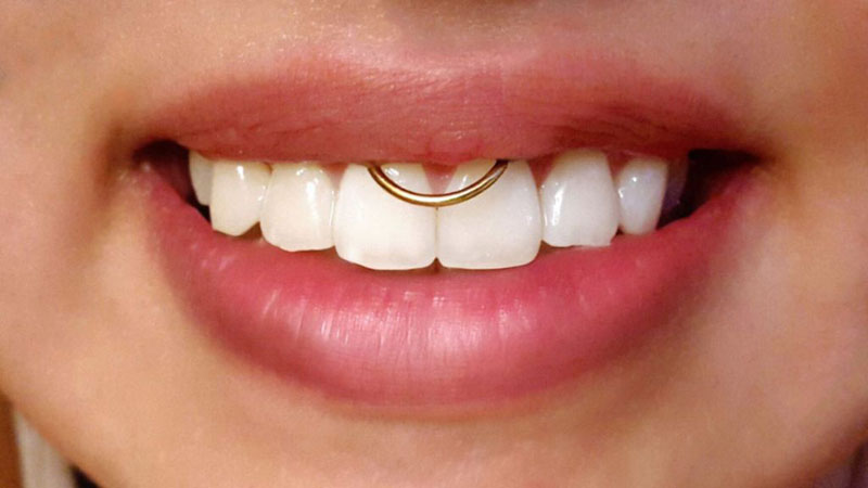 Piercing no smile: informações e inspirações para ter o seu - Bem Resolvida